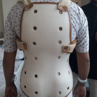 36